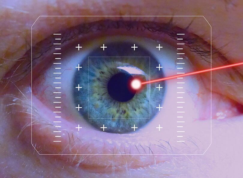 laser featured 810x594 1